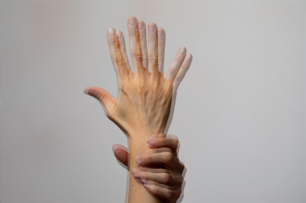 Çift Görme (Diplopi) Nedir?