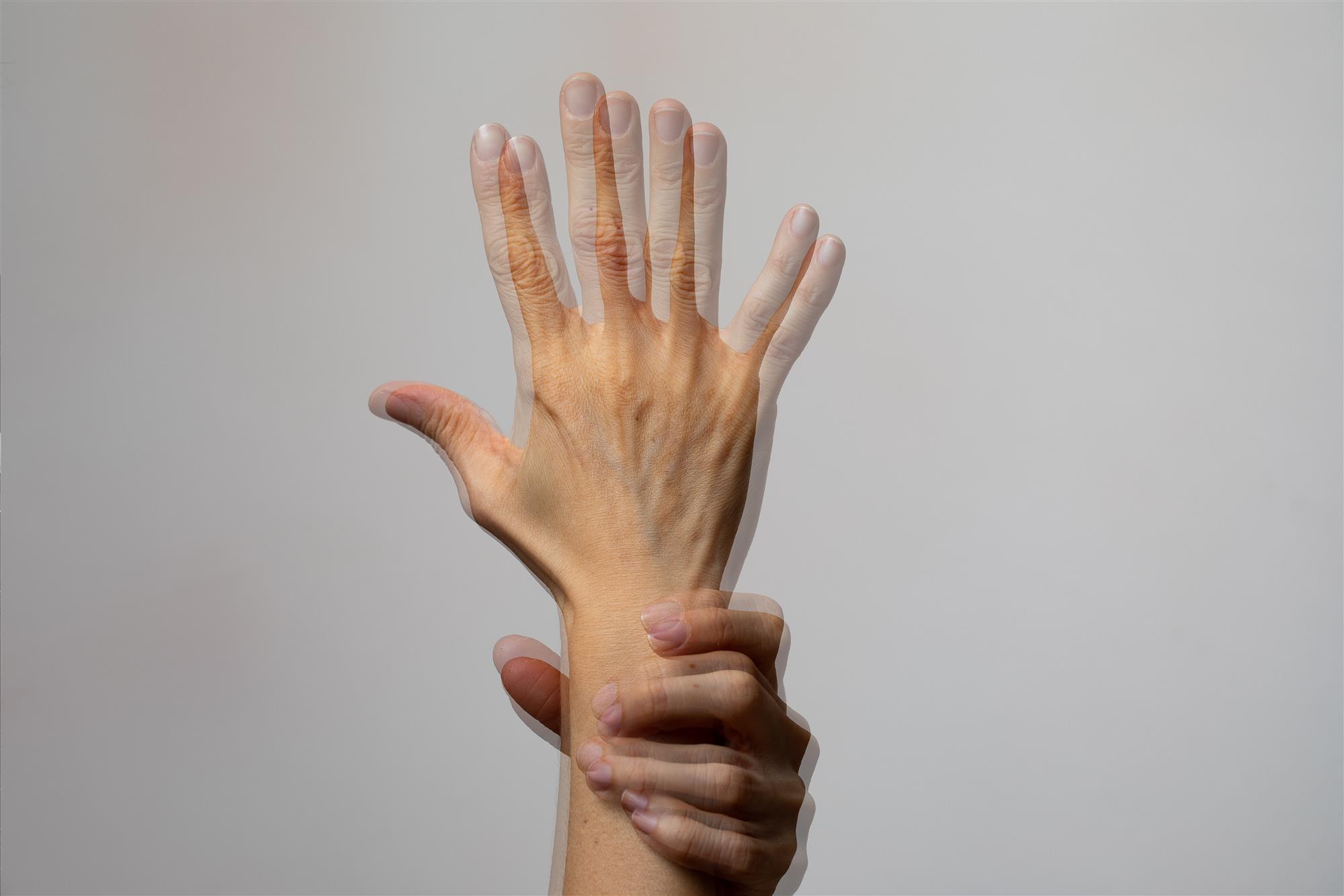 Çift Görme (Diplopi) Nedir?