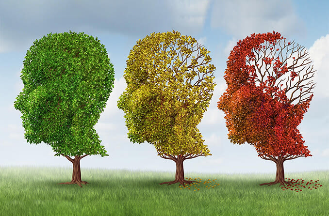 Gözler ile Alzheimer Hastalığı Arasında Bir Bağlantı Var mı?