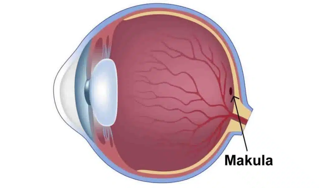 Makula Hastalıkları, Teşhis ve Tedavi