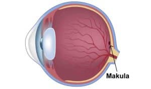 Makula Hastalıkları, Teşhis ve Tedavi