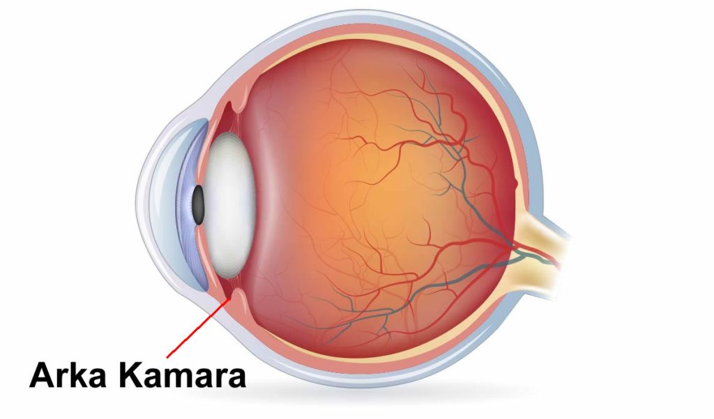 Arka Kamara Nedir?